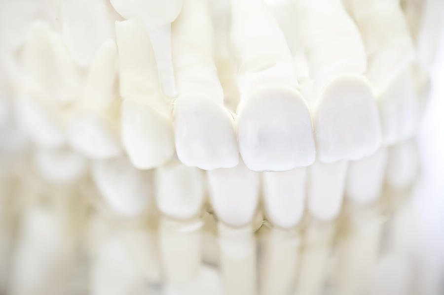 Set Of White Teeth Dentures Photograph by Wakila