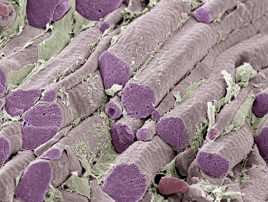Skeletal muscle fibers, colored scanning electron micrograph (SEM) Photograph by Science Photo Library - STEVE GSCHMEISSNER.