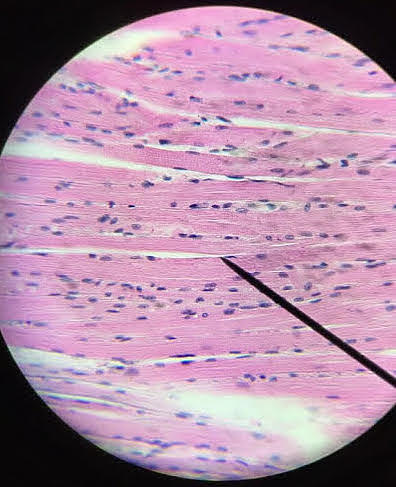 Skeletal Muscle The Beauty of Biology Photograph by Brittany ...