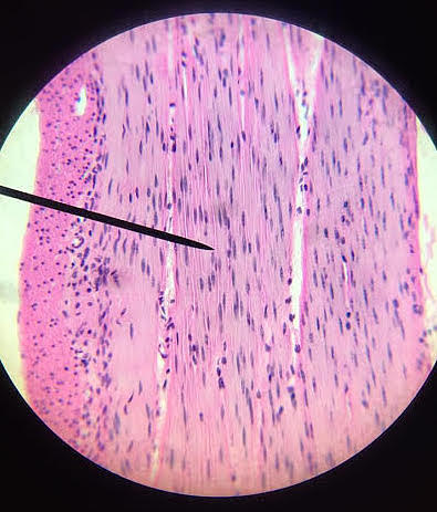 Smooth Muscle The Beauty of Biology Photograph by Brittany Borlinghaus ...