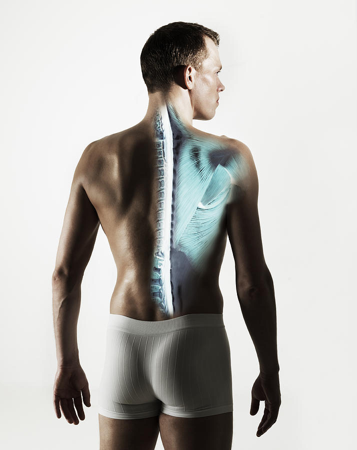 Standing male back with spine visible Photograph by Henrik Sorensen