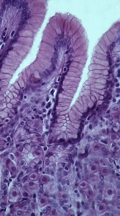 STOMACH--Epithelial lining showing GASTRIC GLANDS, including Gastric Pits, Parietal Cells and Chief Cells, 100X Photograph by Ed Reschke