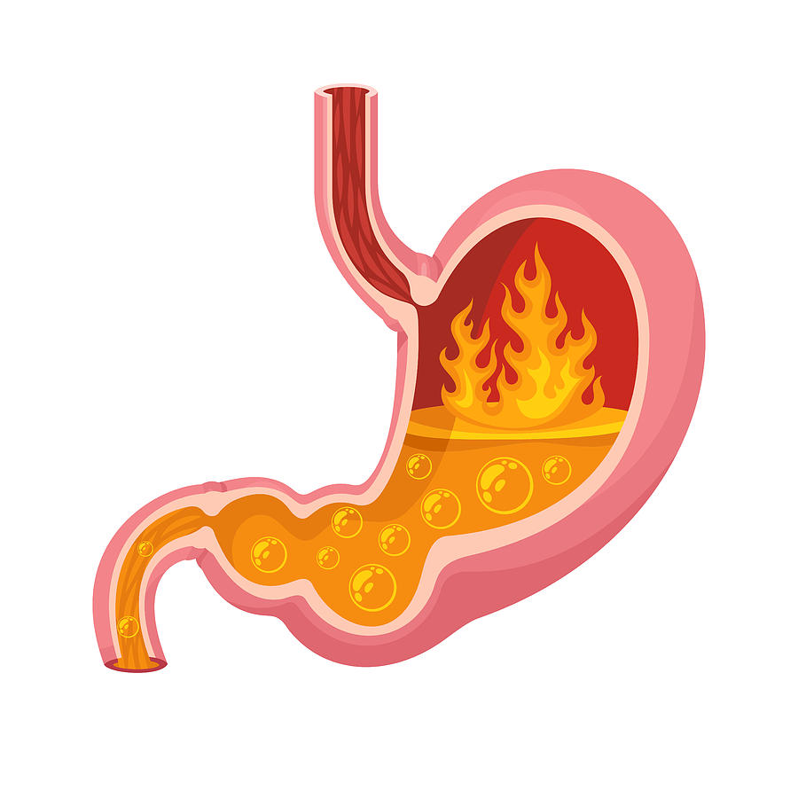 Stomach heartburn vector Drawing by AlonzoDesign