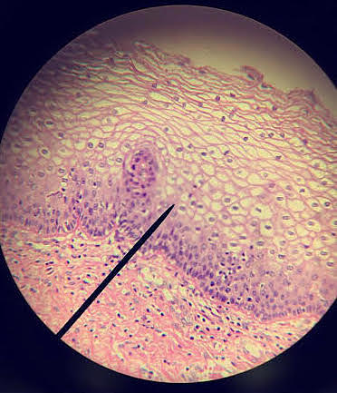 Stratified Squamous Epithelium The Beauty of Biology Photograph by ...