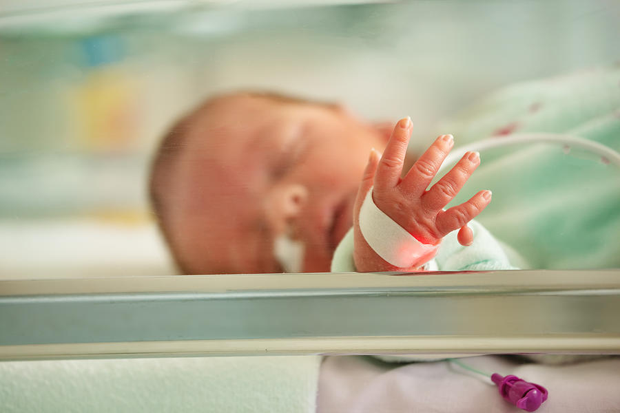 Supernumerary finger, Polydactyly case of newborn portrait Photograph by SerrNovik