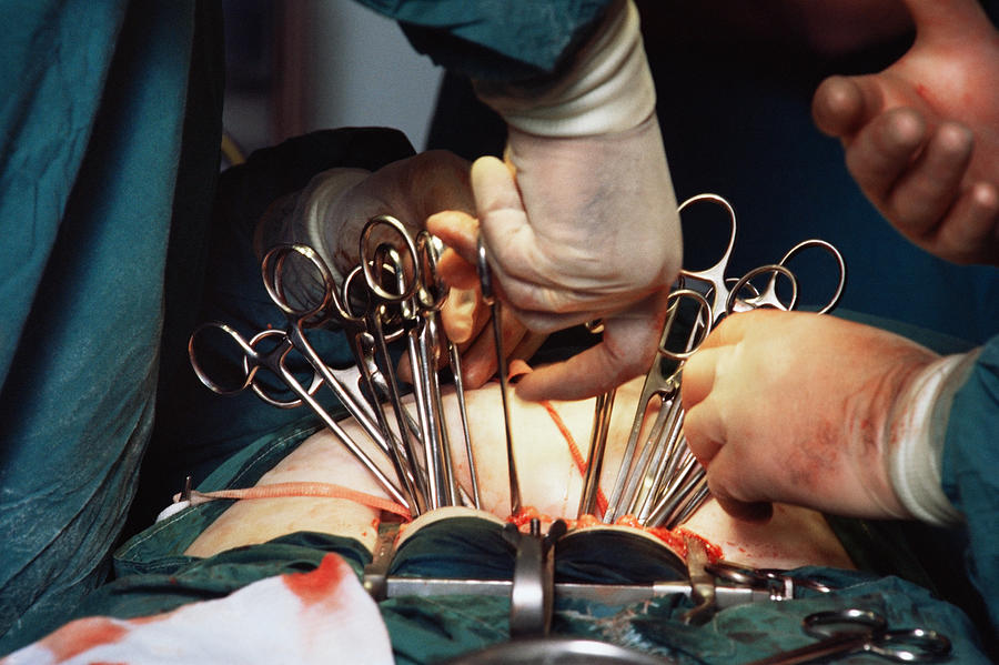 Surgeons performing a hysterectomy Photograph by Image Source