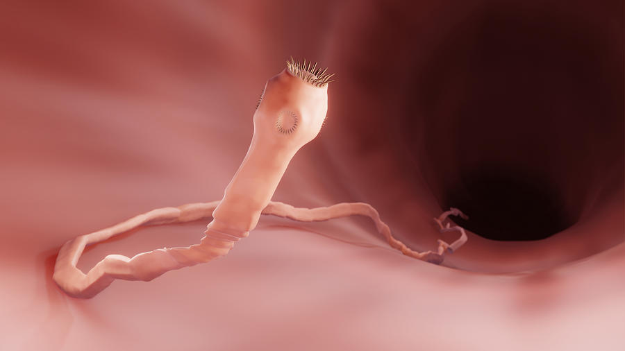 Tapeworm in the intestine, illustration Drawing by Artur Plawgo / Science Photo Library Tapeworm in the intestine, illustration Drawing by Artur Plawgo / Science Photo Library