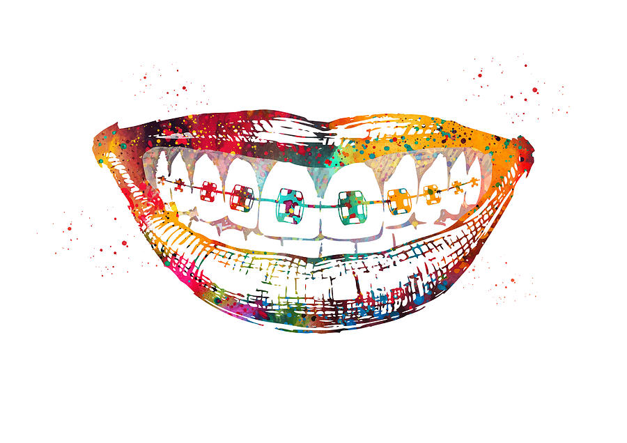 Teeth braces Digital Art by Erzebet S - Pixels