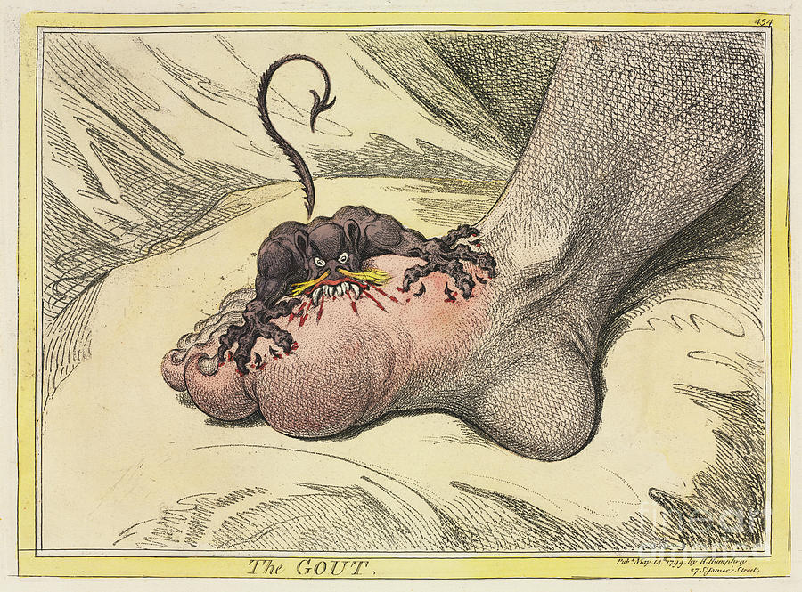 The Gout 1799 by James Gillray t1 Photograph by Historic illustrations