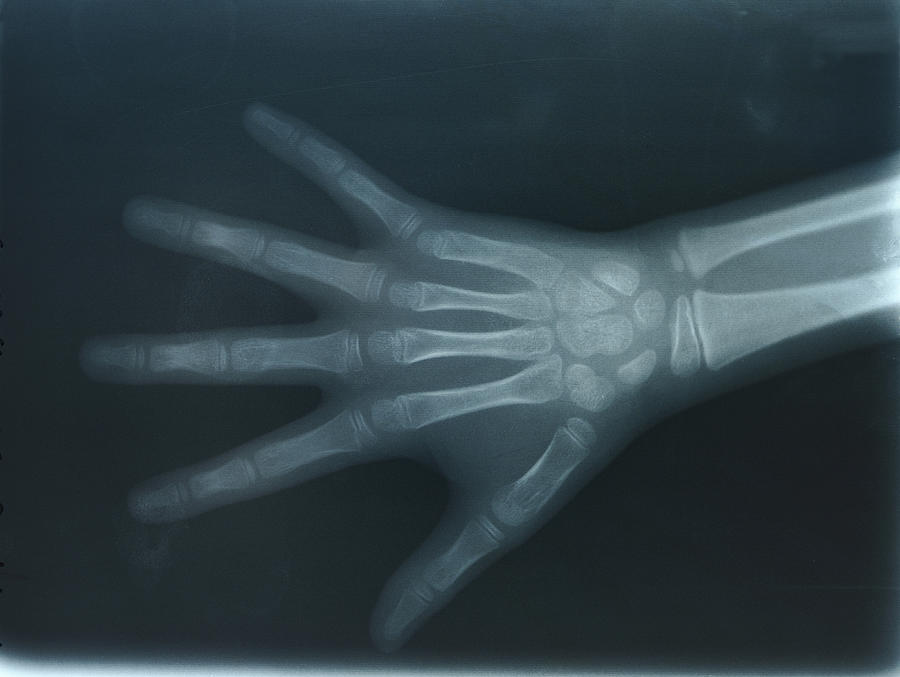 The hand of the child reflected by X-rays Photograph by Yagi Studio