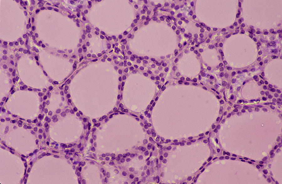 THYROID GLAND. 100X Shows: follicles, colloid, and simple cuboidal epithelium. Human. Photograph by Ed Reschke THYROID GLAND. 100X Shows: follicles, colloid, and simple cuboidal epithelium. Human. Photograph by Ed Reschke