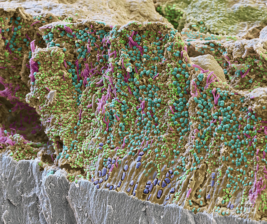 Tooth Plaque SEM Photograph by Eye of Science