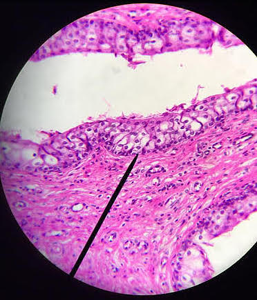 Transitional Epithelium The Beauty Of Biology Photograph By Brittany 