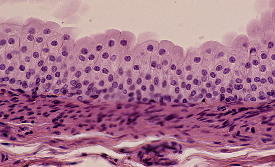 TRANSITIONAL EPITHELIUM, URETER, 100X Shows: many cell layers, cells near the surface that are pear-shaped, supporting connective below. Unstretched state. Also, found in the bladder. Photograph by Ed Reschke
