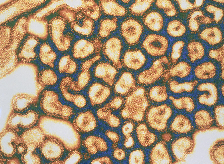 Transmission Electron Micrograph (TEM) of flu virus Photograph by Dr Gopal Murti/spl