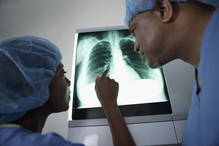 Two doctors having a discussion about an x-ray of a human lung Photograph by Medioimages/Photodisc