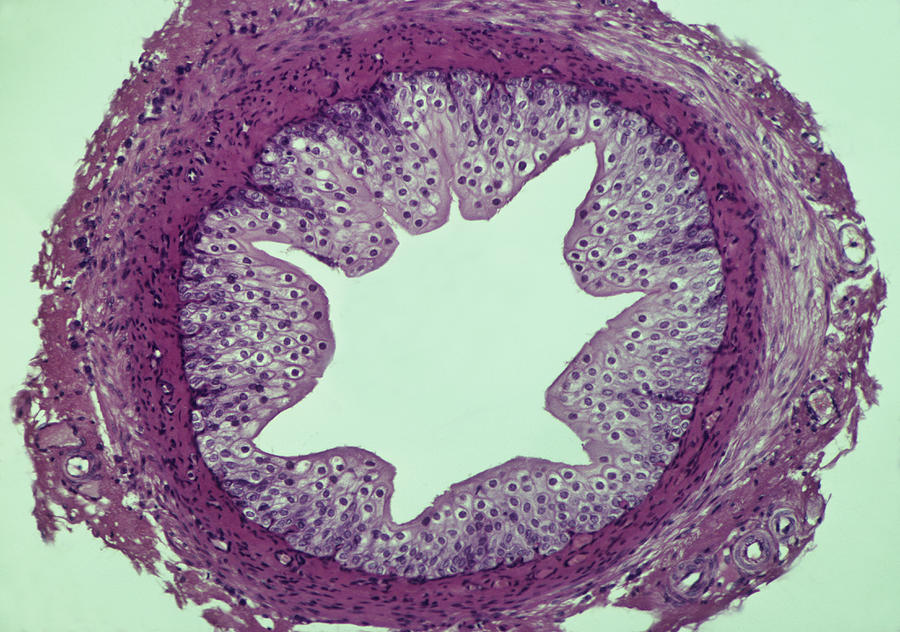 Ureter--Mucosa, Muscularis, and Adventitia, 25X Photograph by Ed Reschke