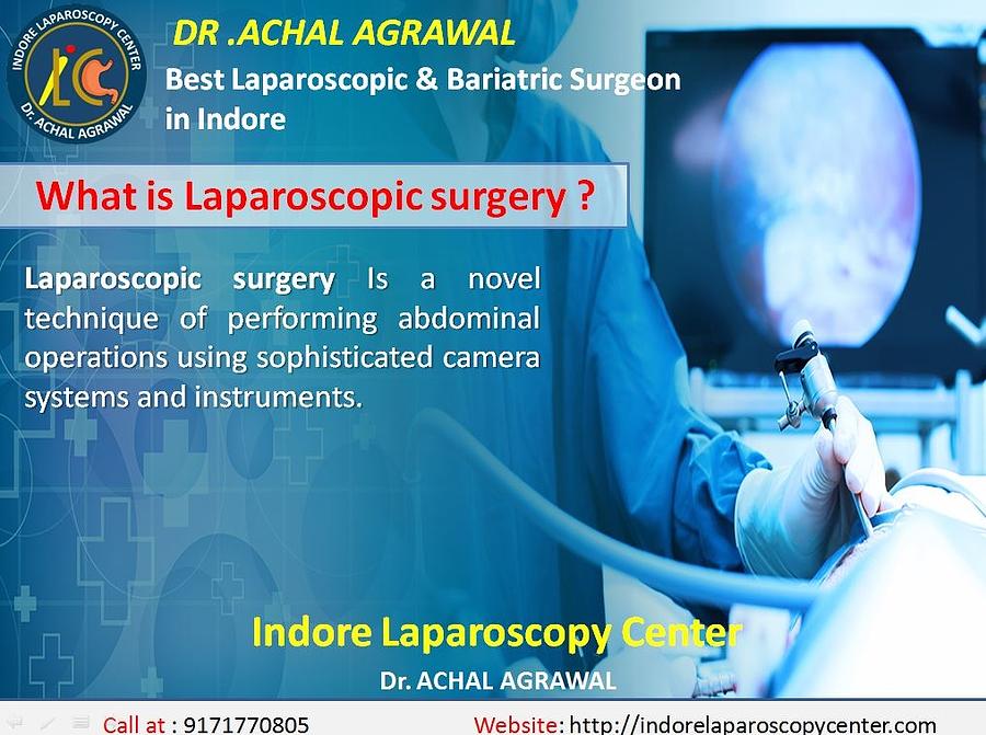 What is Laparoscopic Surgery? Indore Laparoscopy Center Indore Mixed ...