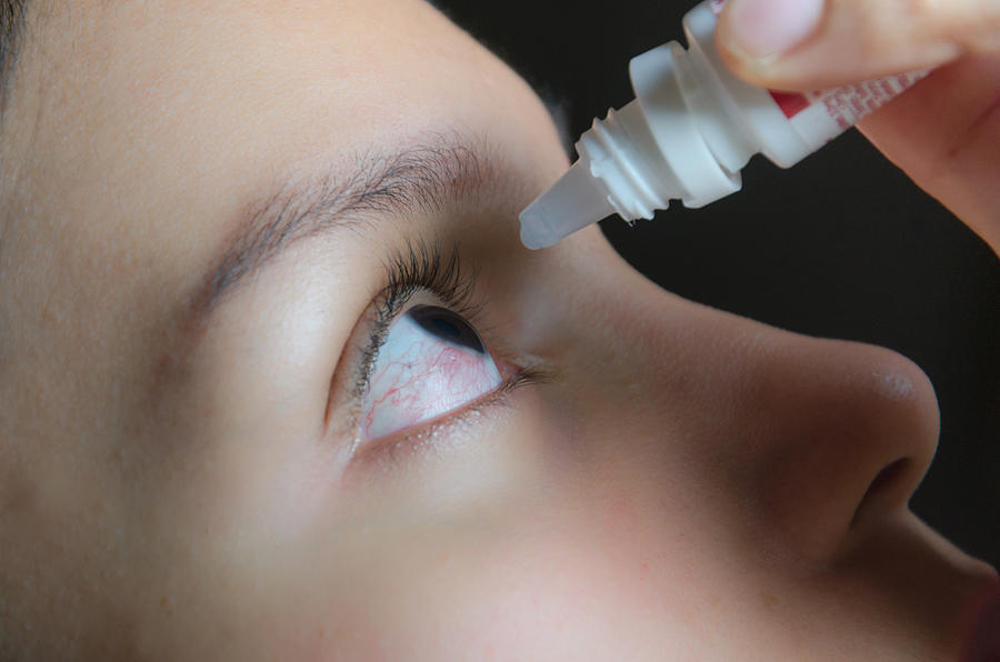 Woman applying eye-drops into her eye Photograph by Elizabeth Fernandez