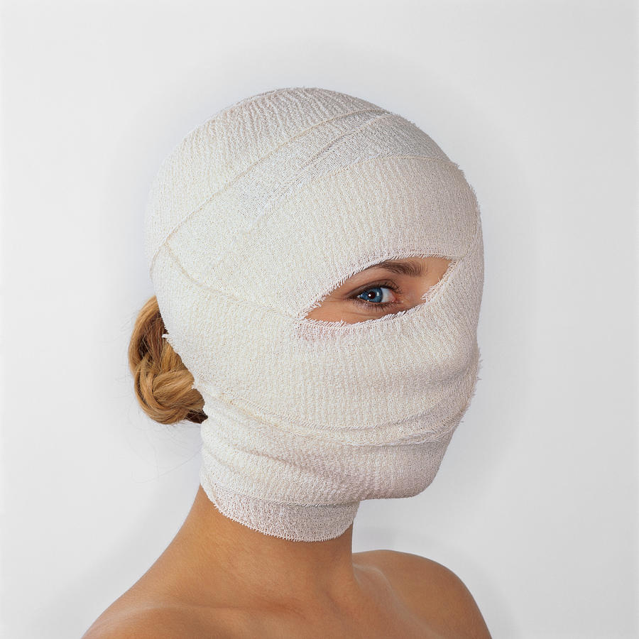 Woman With Her Head Covered With Bandages With Just One Eye Uncovered Photograph by Stockbyte