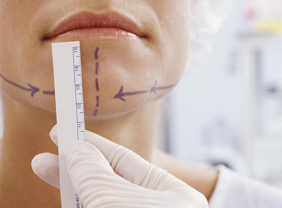 Woman With Pen Marks on Her Face Having Her Chin Measured for Cosmetic Surgery Photograph by Andrew Olney