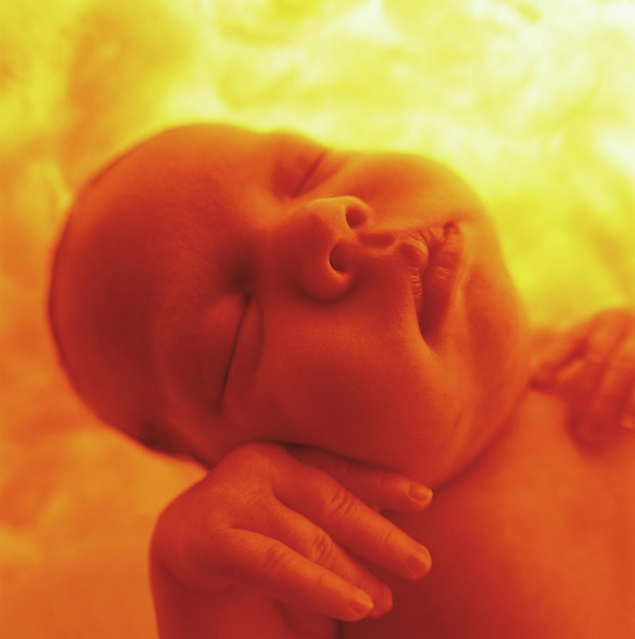 Colour Photograph - Womb Series #2 by Anne Geddes