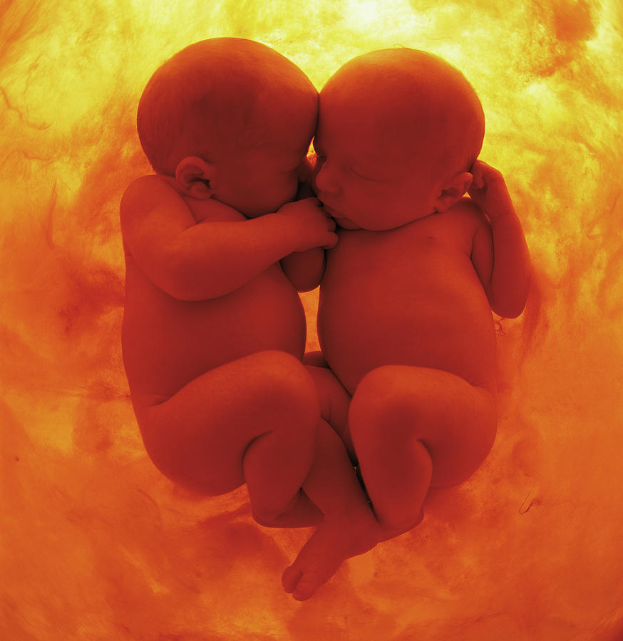 Color Photograph - Womb Series #3 by Anne Geddes