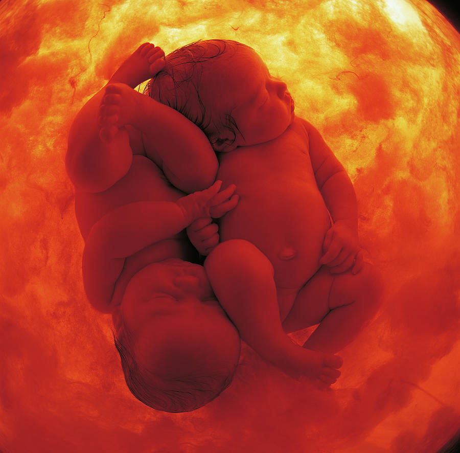 Color Photograph - Womb Series #9 by Anne Geddes
