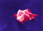 Cancer Cell Death, Sem 6 Of 6 #1 Photograph by Science Source