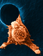 Metastasis #3 Photograph by Science Source