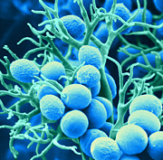 Peronospora Parasitica #1 Photograph by Biophoto Associates and Photo Researchers