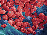 Human Red Blood Cells, Sem #16 Photograph by Ted Kinsman