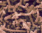 Bifidobacterium Longum, Sem Photograph by Scimat