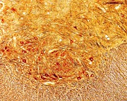 Motor Neurons In Spinal Cord #1 Photograph by Science Photo Library