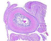 Ossification. Immature Bone #1 Photograph by Jose Luis Calvo