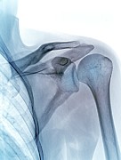 Shoulder Joint #1 Photograph by Science Photo Library