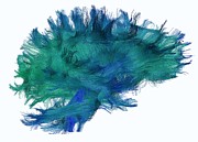 White Matter Fibres #1 Photograph by Science Photo Library