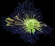 Chemotherapy #18 Photograph by Steve Gschmeissner/science Photo Library