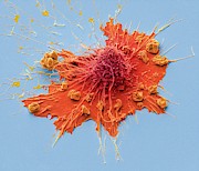 Fibroblast Cell #4 Photograph by Science Photo Library