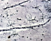 Microglia #4 Photograph by Science Photo Library