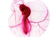 Chicken Embryo #5 Photograph by Science Photo Library