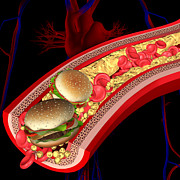 Cholesterol #65 Photograph by Science Photo Library