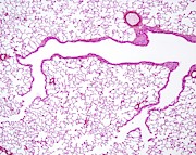 Bronchioles Photograph by Science Photo Library