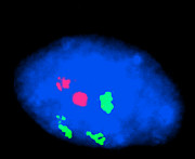 Fish Micrograph Of Chromosomes In Trisomy 18 Photograph by Science Photo Library