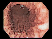Normal Stomach Photograph by Science Photo Library