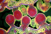 Poppy Ovary With Developing Seeds Photograph by Science Photo Library