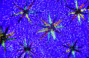 Stellate Leaf Hairs Photograph by Science Photo Library