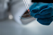 Drop of blood or red liquid being dripped on a microscope slide Photograph by Fotostorm