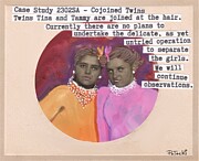 Medical Case Study Conjoined Twins Painting by Jo Potocki