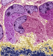 Osteoblasts, TEM Photograph by Steve Gschmeissner/science Photo Library